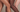 IPL vs Laser Hair Removal: Which One is Better for You? 2023
