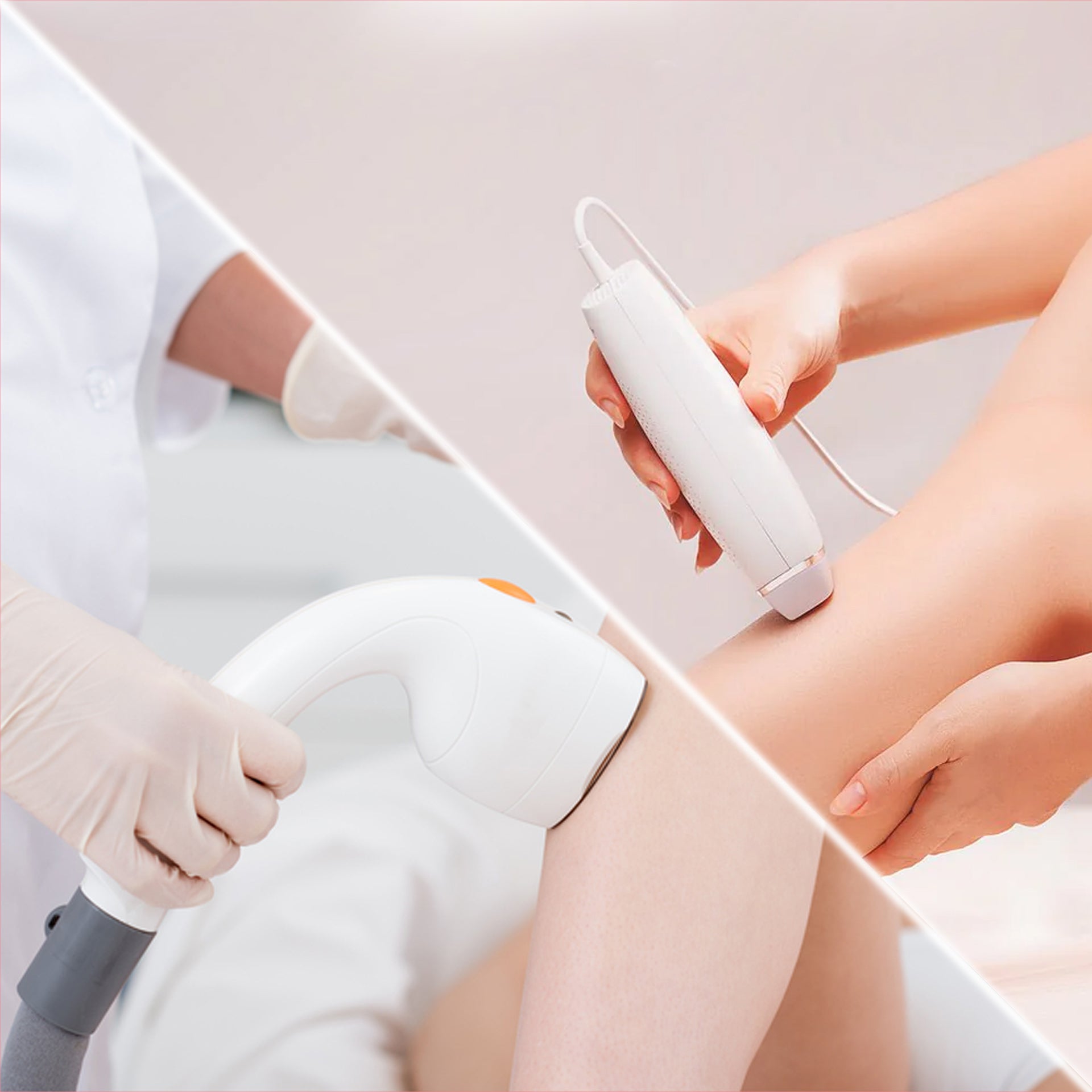 why women need a laser shoulder hair removal – Koizuma®
