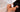 What Is IPL Hair Removal and How Is It Compared to Laser? 2023